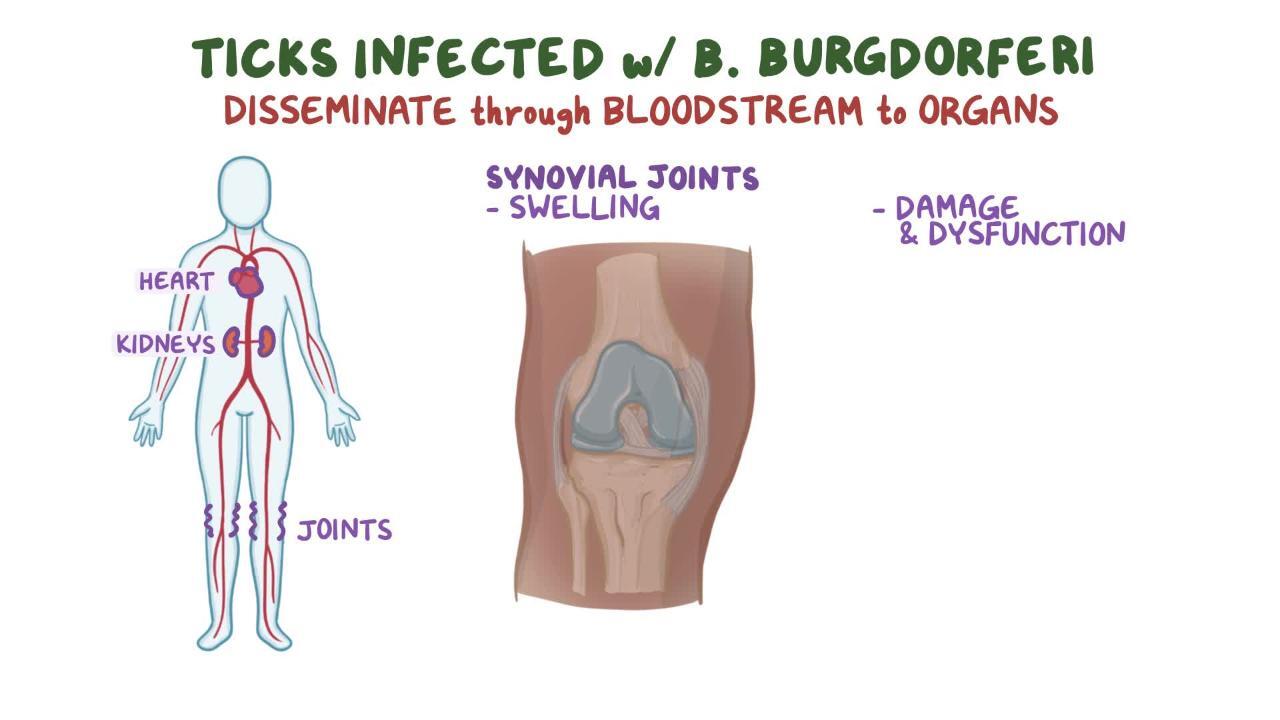 Lyme Disease